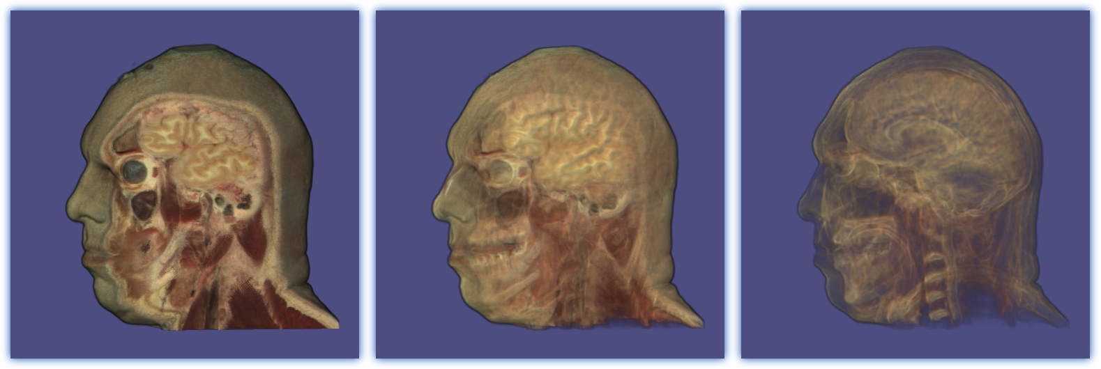 Visible Human
